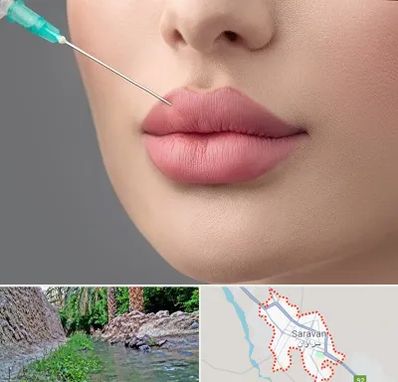 کلینیک ژل لب روسی در سراوان