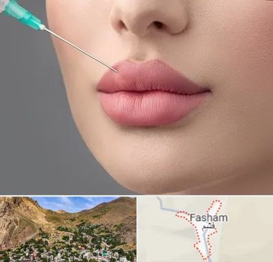 کلینیک ژل لب روسی در فشم