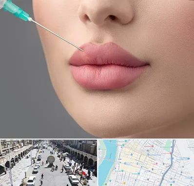 کلینیک ژل لب روسی در نادری اهواز