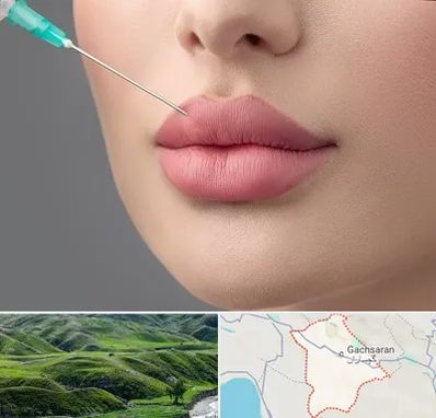 کلینیک ژل لب روسی در گچساران