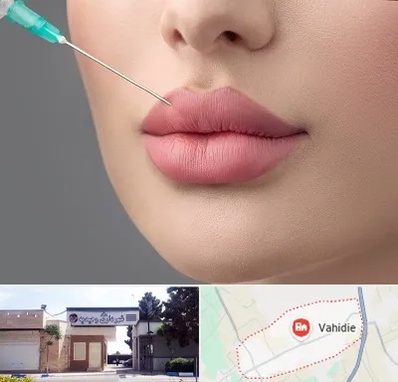 کلینیک ژل لب روسی در وحیدیه شهریار