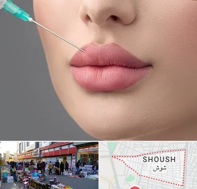 کلینیک ژل لب روسی در شوش