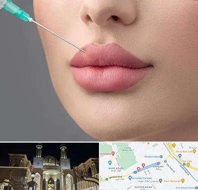 کلینیک ژل لب روسی در زرگری شیراز