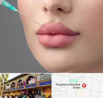 کلینیک ژل لب روسی در 15 خرداد