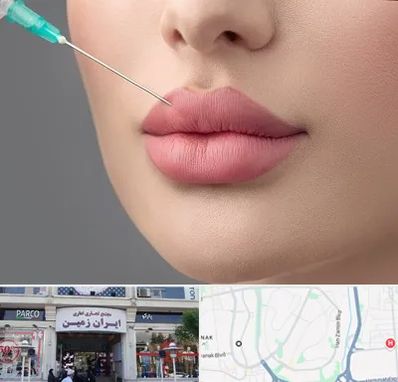 کلینیک ژل لب روسی در ایران زمین