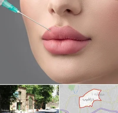 کلینیک ژل لب روسی در دزاشیب
