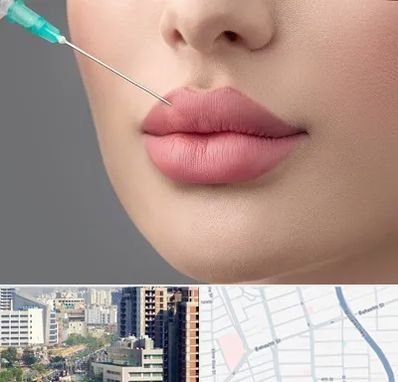 کلینیک ژل لب روسی در خیابان بهشتی