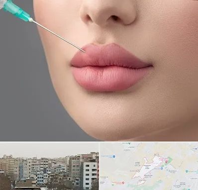 کلینیک ژل لب روسی در محمد شهر کرج