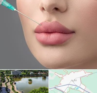 کلینیک ژل لب روسی در لنگرود