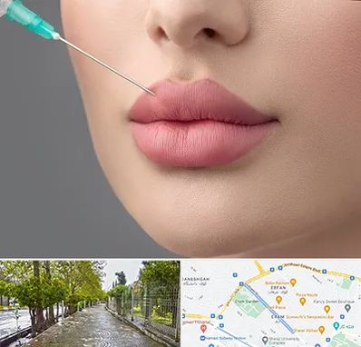 کلینیک ژل لب روسی در خیابان ارم شیراز