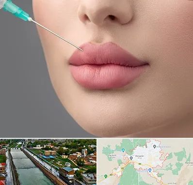 کلینیک ژل لب روسی در مراغه