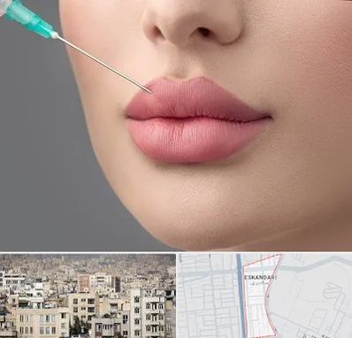 کلینیک ژل لب روسی در اسکندری