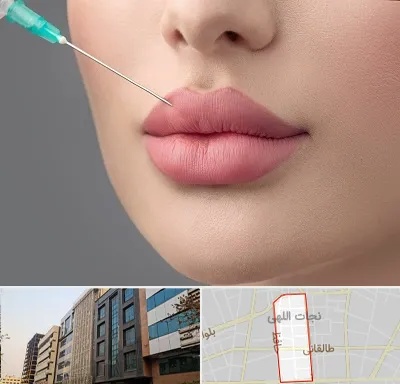 کلینیک ژل لب روسی در نجات اللهی
