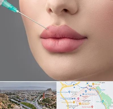 کلینیک ژل لب روسی در معالی آباد شیراز