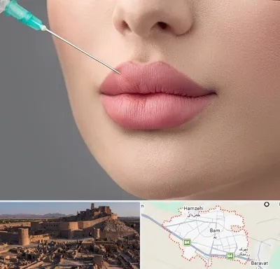 کلینیک ژل لب روسی در بم