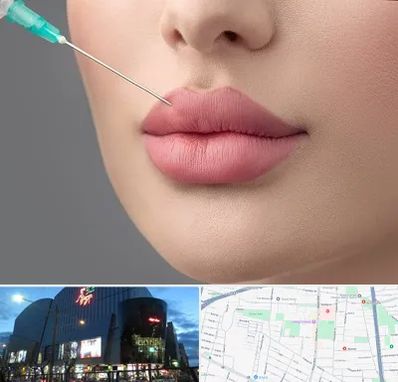 کلینیک ژل لب روسی در بلوار اباذر