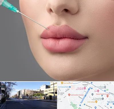 کلینیک ژل لب روسی در خیابان ملاصدرا شیراز