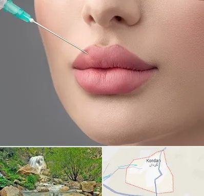 کلینیک ژل لب روسی در کردان