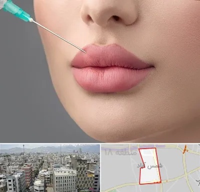 کلینیک ژل لب روسی در شمس آباد تهران