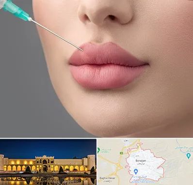 کلینیک ژل لب روسی در برازجان