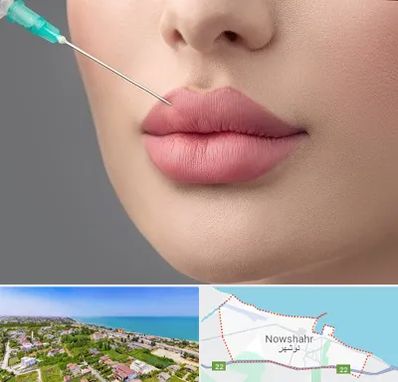کلینیک ژل لب روسی در نوشهر