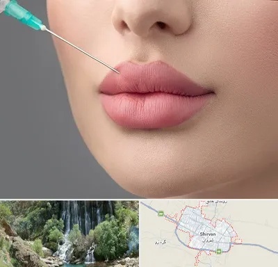 کلینیک ژل لب روسی در شیروان