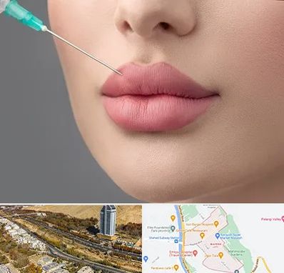 کلینیک ژل لب روسی در خیابان نیایش شیراز