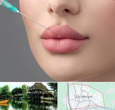 کلینیک ژل لب روسی در صومعه سرا