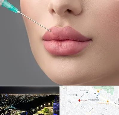 کلینیک ژل لب روسی در هفت تیر مشهد