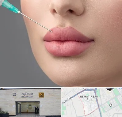 کلینیک ژل لب روسی در نعمت آباد
