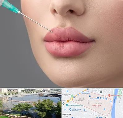 کلینیک ژل لب روسی در گلستان اهواز