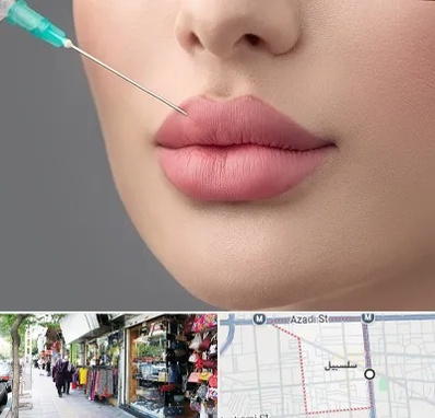 کلینیک ژل لب روسی در سلسبیل