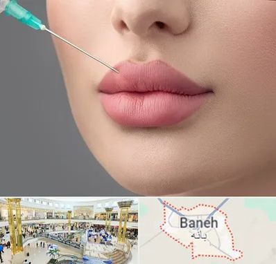 کلینیک ژل لب روسی در بانه