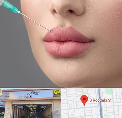 کلینیک ژل لب روسی در رودکی