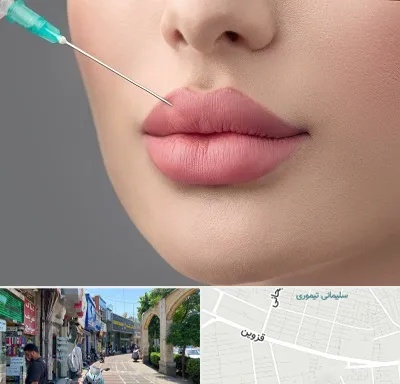 کلینیک ژل لب روسی در خیابان قزوین