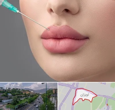 کلینیک ژل لب روسی در لویزان