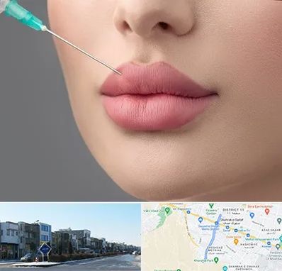 کلینیک ژل لب روسی در شریعتی مشهد