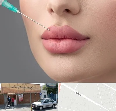 کلینیک ژل لب روسی در وردآورد