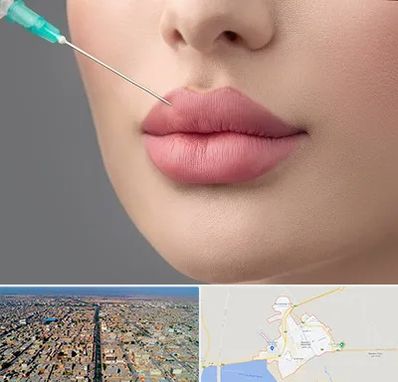 کلینیک ژل لب روسی در بندر ماهشهر
