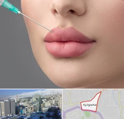 کلینیک ژل لب روسی در محمودیه