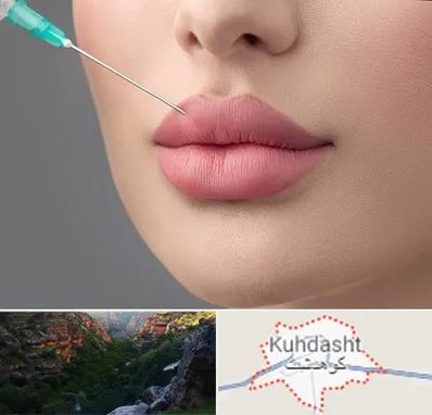 کلینیک ژل لب روسی در کوهدشت