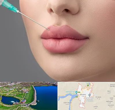 کلینیک ژل لب روسی در مهاباد