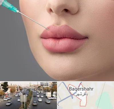 کلینیک ژل لب روسی در باقرشهر