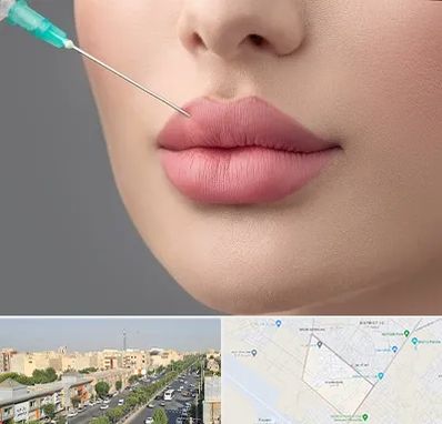 کلینیک ژل لب روسی در کیانمهر کرج