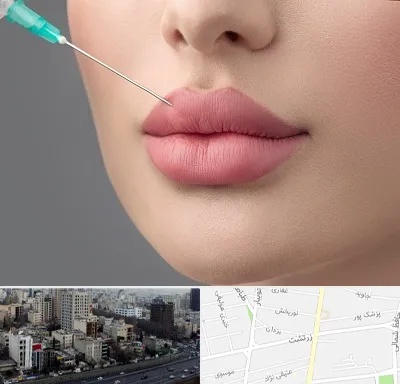 کلینیک ژل لب روسی در زرتشت
