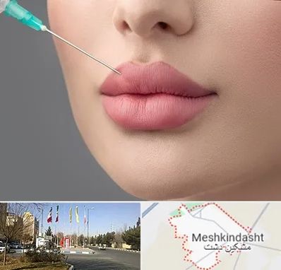 کلینیک ژل لب روسی در مشکین دشت