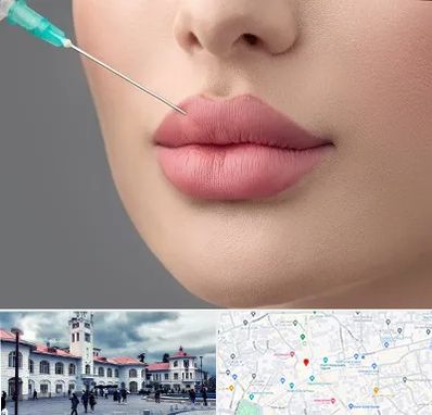 کلینیک ژل لب روسی در میدان شهرداری رشت