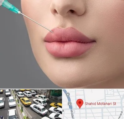 کلینیک ژل لب روسی در مطهری تهران
