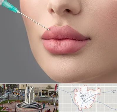 کلینیک ژل لب روسی در زابل
