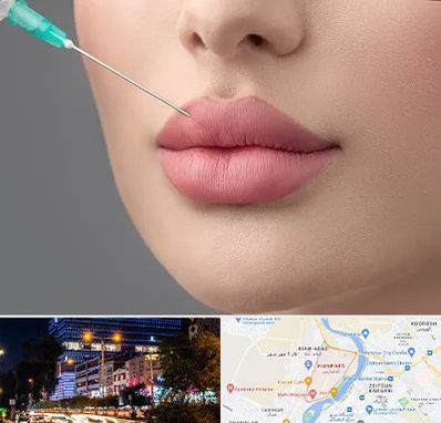 کلینیک ژل لب روسی در کیانپارس اهواز